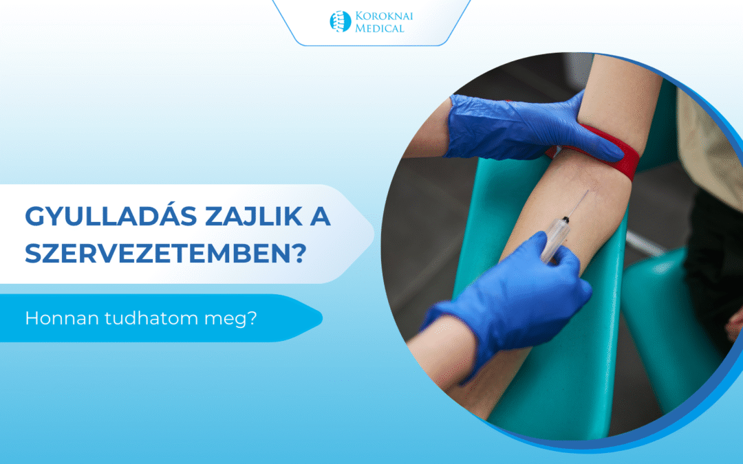 Gyulladás zajlik a szervezetemben? Honnan tudhatom meg?