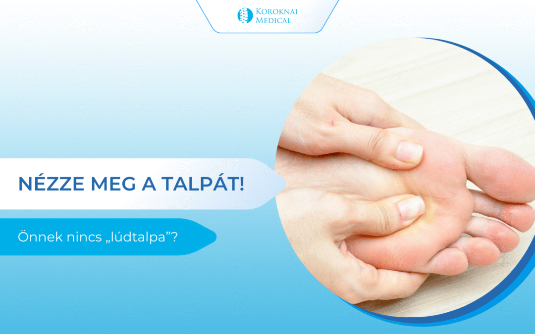 Nézze meg a talpát! Önnek nincs „lúdtalpa”?