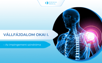 Vállfájdalom okai I. – Az impingement szindróma