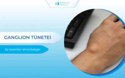 Ganglion tünetei és kezelése
