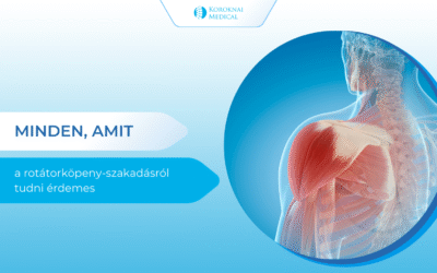 Minden, amit a rotátorköpeny-szakadásról tudni érdemes