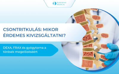 Csontritkulás szűrés: mikor kell DEXA, mit mutat a FRAX és hogyan előzhető meg a törés?